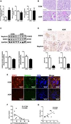 Serum and Glucocorticoid-Inducible Kinase 3/Nedd4-2 Signaling Pathway Participates in Podocyte Injury by Regulating the Stability of Nephrin